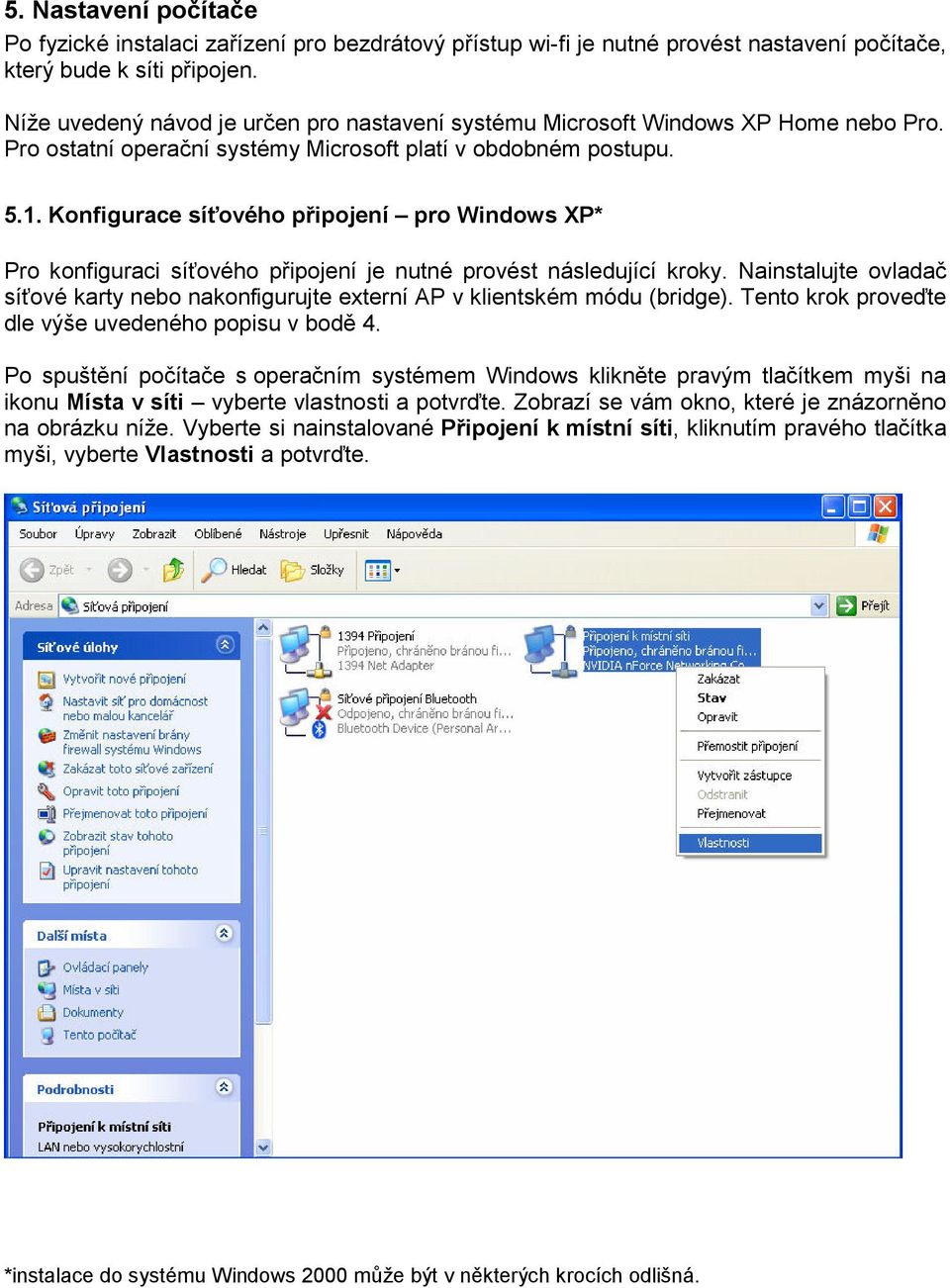 Konfigurace síťového připojení pro Windows XP* Pro konfiguraci síťového připojení je nutné provést následující kroky.