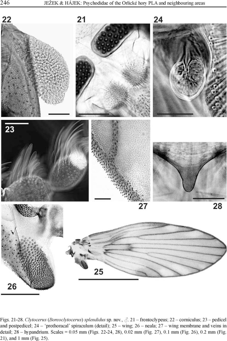 21 frontoclypeus; 22 corniculus; 23 pedicel and postpedicel; 24 prothoracal spiraculum (detail); 25 wing;