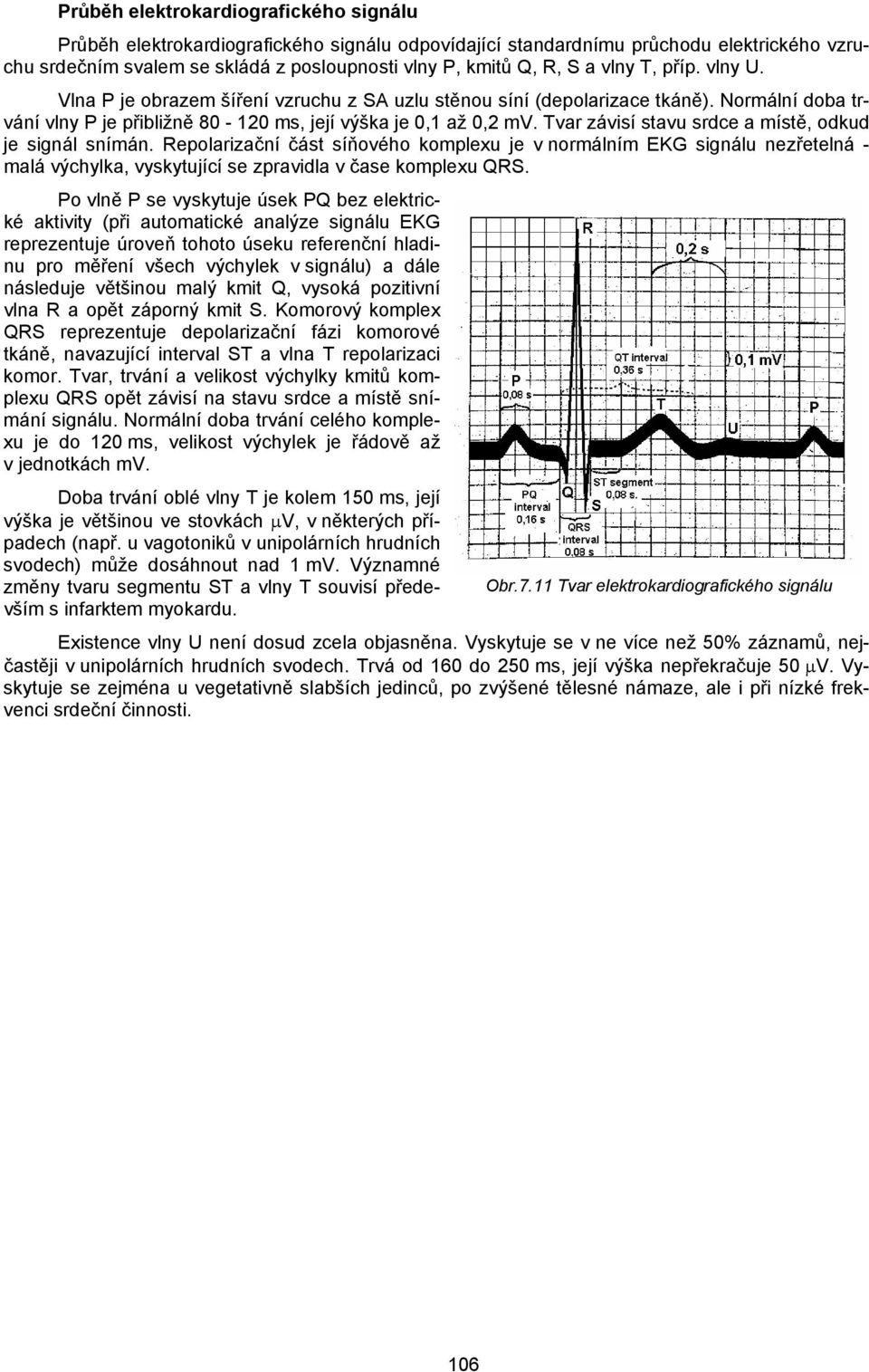 Tvar závisí stavu srdce a místě, odkud je signál snímán. Repolarizační část síňového komplexu je v normálním EKG signálu nezřetelná - malá výchylka, vyskytující se zpravidla v čase komplexu QRS.