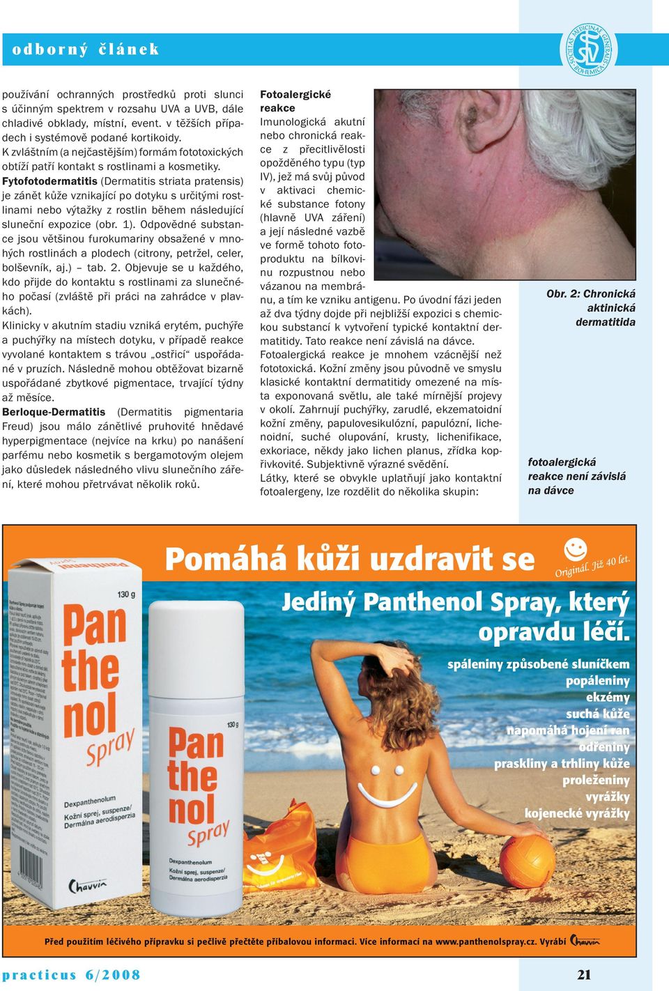 Fytofotodermatitis (Dermatitis striata pratensis) je zánět kůže vznikající po dotyku s určitými rostlinami nebo výtažky z rostlin během následující sluneční expozice (obr. 1).