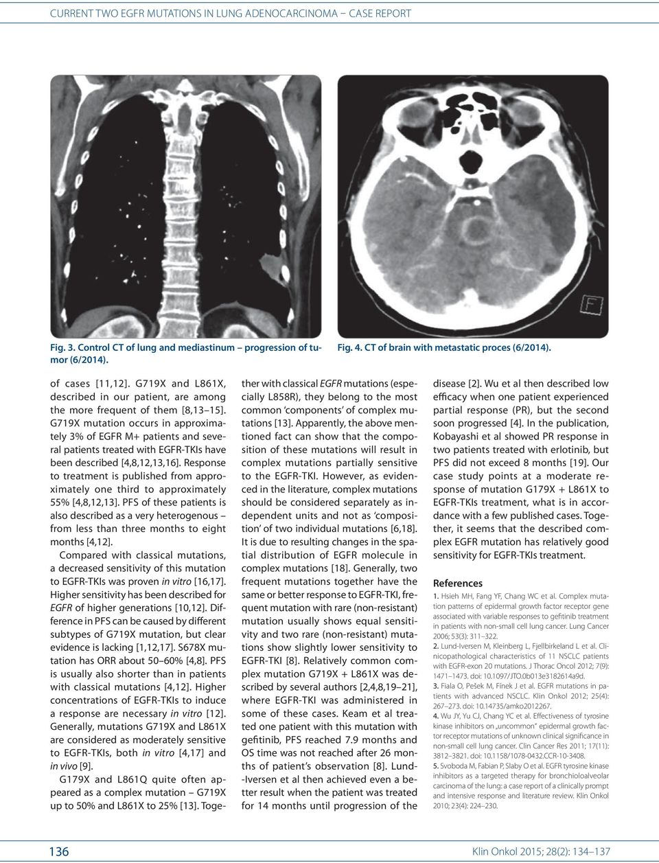 G719X mutation occurs in approximately 3% of EGFR M+ patients and several patients treated with EGFR- TKIs have been described [4,8,12,13,16].