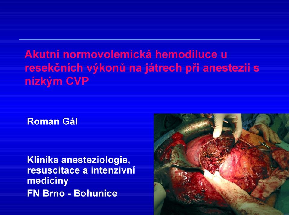 nízkým CVP Roman Gál Klinika anesteziologie,