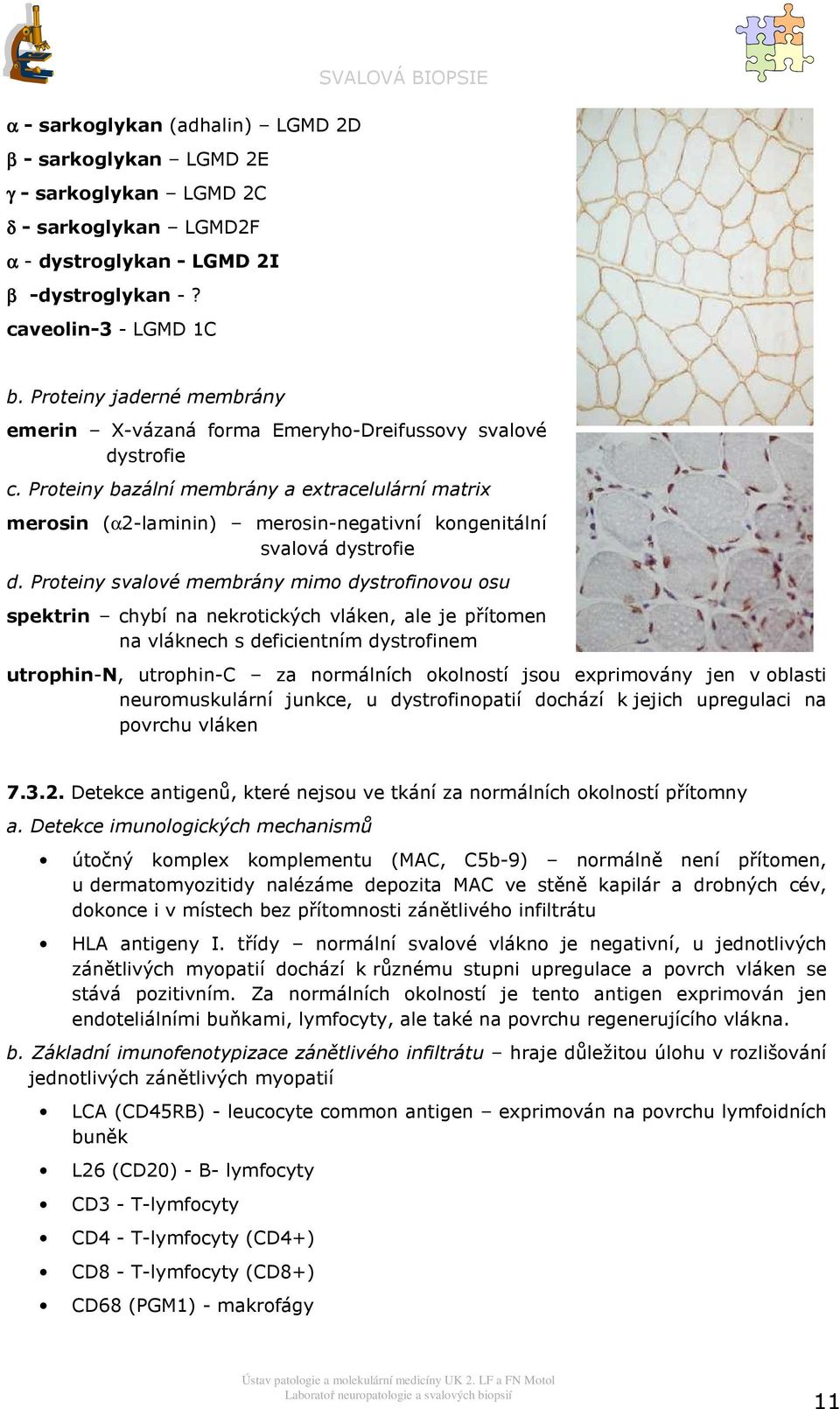 Prteiny svalvé membrány mim dystrfinvu su spektrin chybí na nekrtických vláken, ale je přítmen na vláknech s deficientním dystrfinem utrphin-n, utrphin-c za nrmálních klnstí jsu exprimvány jen v