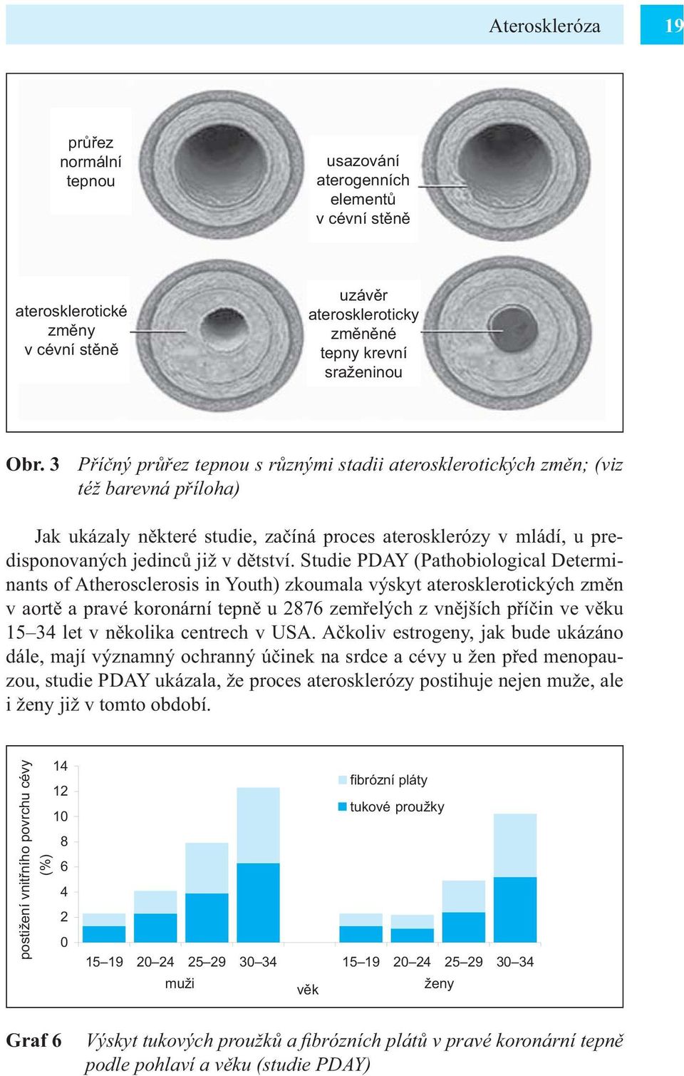 Studie PDAY (Pathobiological Determinants of Atherosclerosis in Youth) zkoumala výskyt aterosklerotických změn v aortě a pravé koronární tepně u 2876 zemřelých z vnějších příčin ve věku 15 34 let v