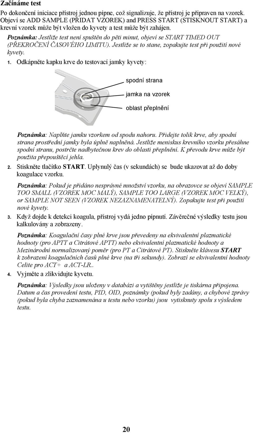 Poznámka: Jestliže test není spuštěn do pěti minut, objeví se START TIMED OUT (PŘEKROČENÍ ČASOVÉHO LIMITU). Jestliže se to stane, zopakujte test při použití nové kyvety. 1.