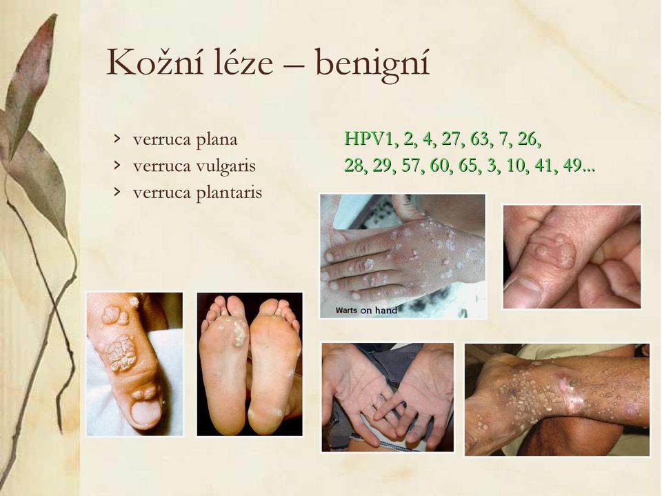 plantaris HPV1, 2, 4, 27, 63, 7,