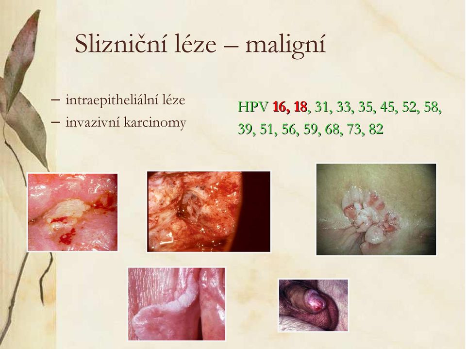 invazivní karcinomy HPV 16, 18,