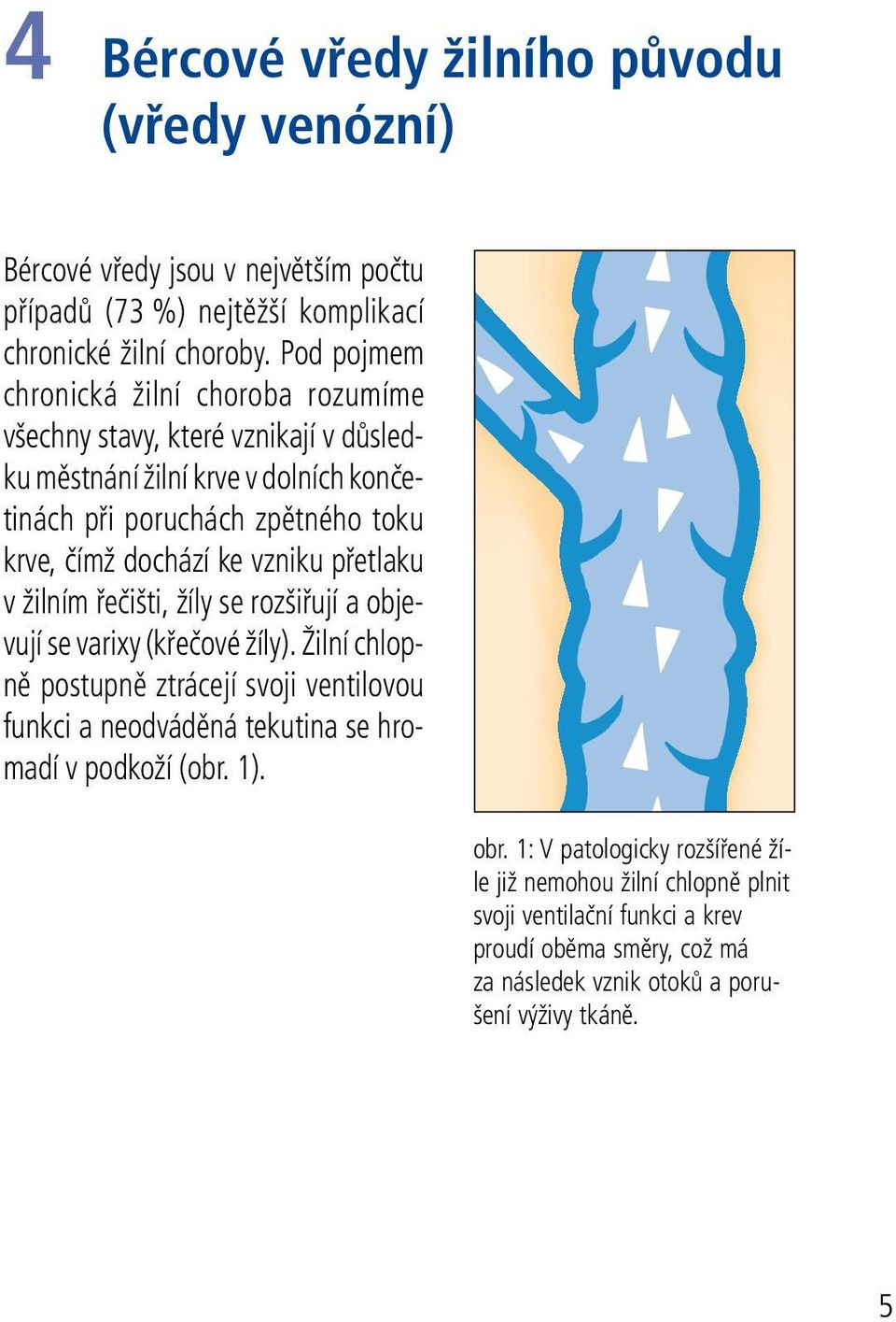 ke vzniku přetlaku v žilním řečišti, žíly se rozšiřují a objevují se varixy (křečové žíly).