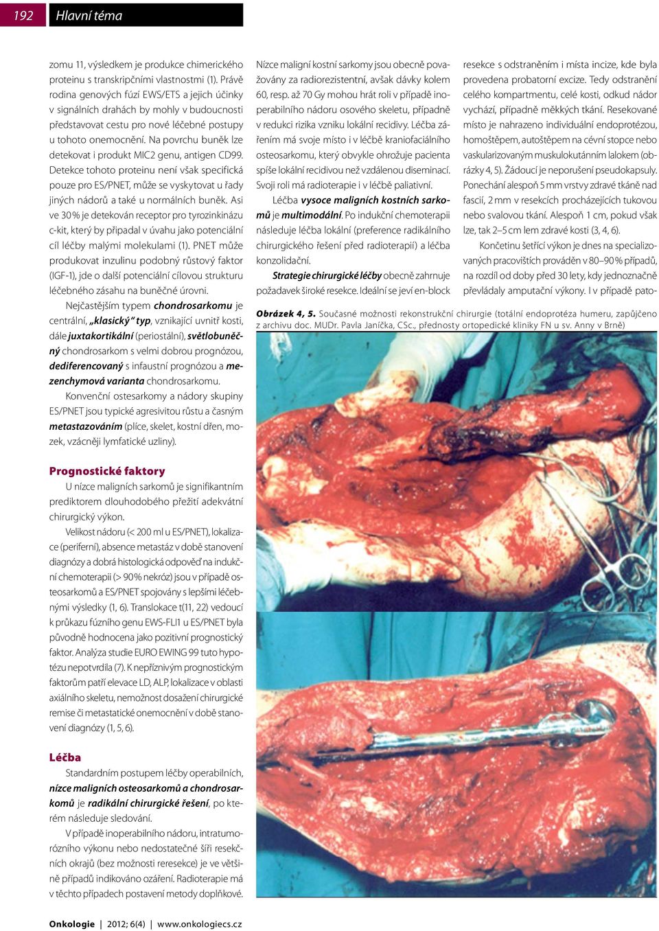 Na povrchu buněk lze detekovat i produkt MIC2 genu, antigen CD99. Detekce tohoto proteinu není však specifická pouze pro ES/PNET, může se vyskytovat u řady jiných nádorů a také u normálních buněk.