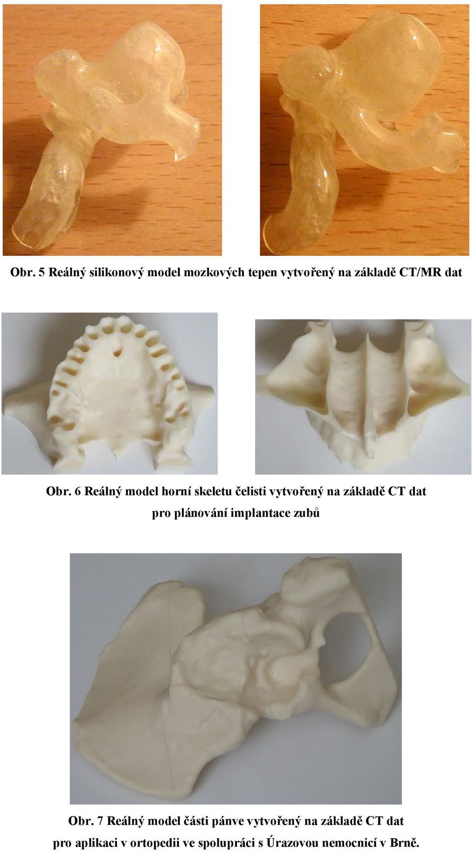 6 Reálný model horní skeletu čelisti vytvořený na základě CT dat pro