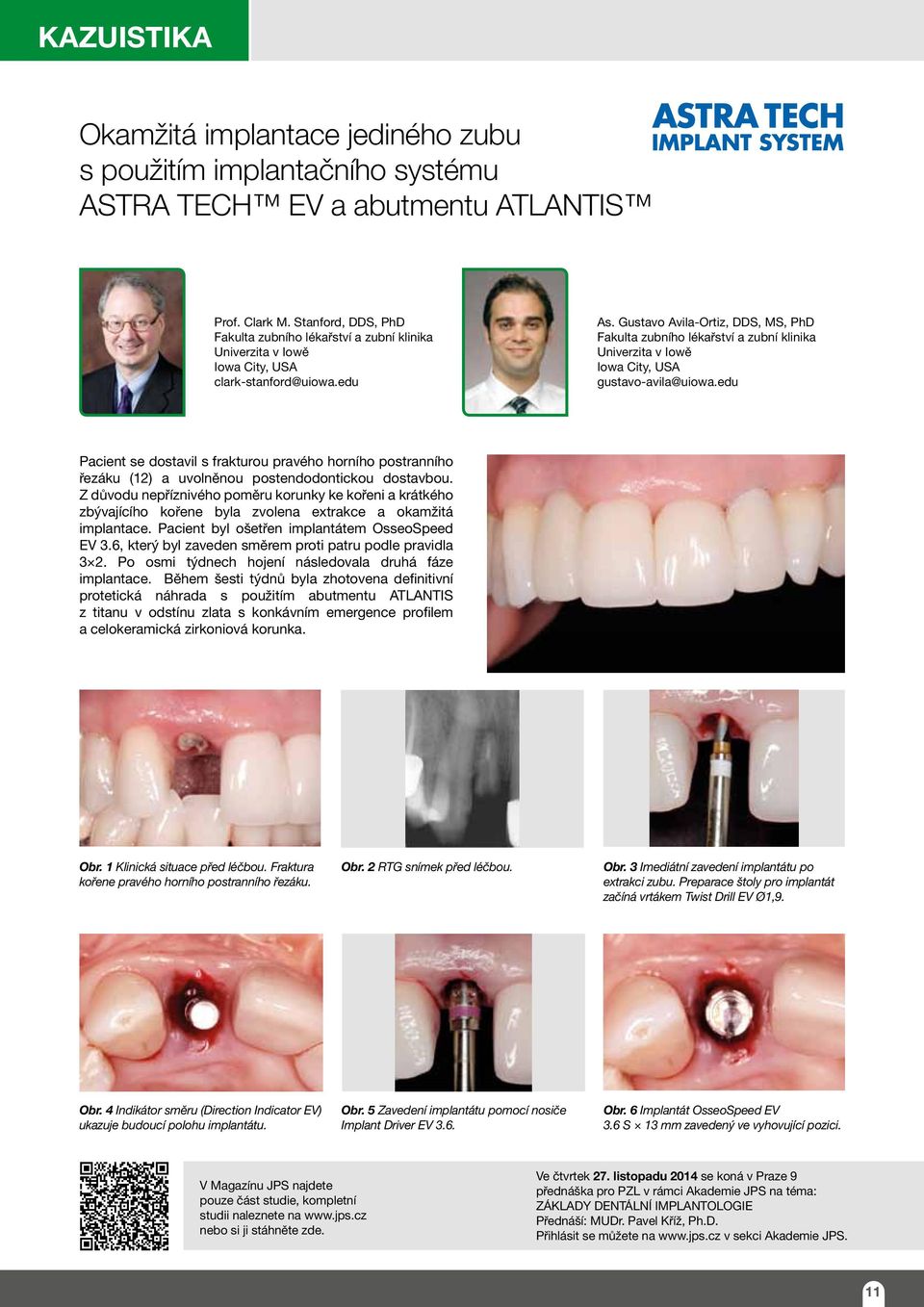 Gustavo Avila-Ortiz, DDS, MS, PhD Fakulta zubního lékařství a zubní klinika Univerzita v Iowě Iowa City, USA gustavo-avila@uiowa.