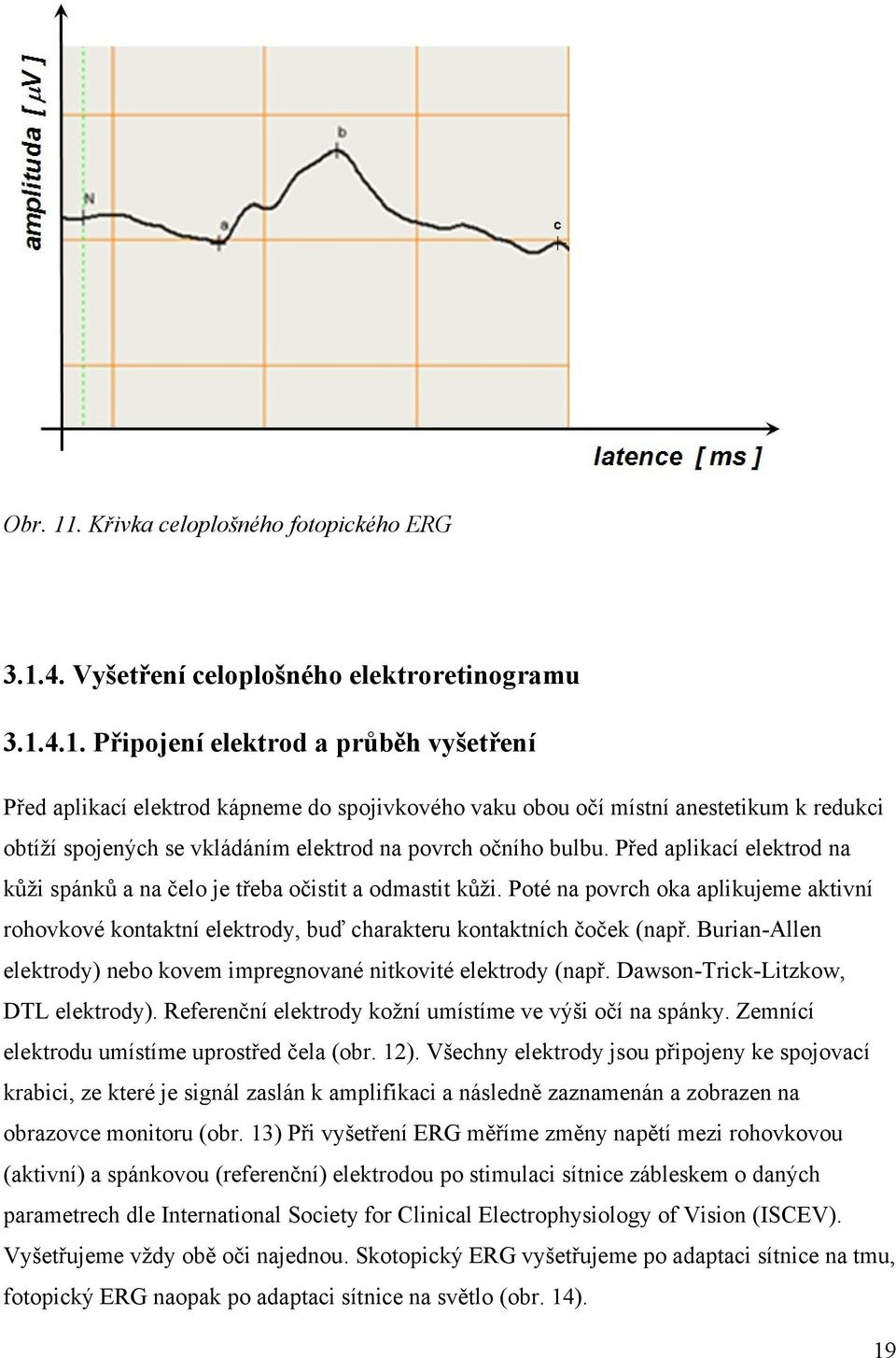 Burian-Allen elektrody) nebo kovem impregnované nitkovité elektrody (např. Dawson-Trick-Litzkow, DTL elektrody). Referenční elektrody kožní umístíme ve výši očí na spánky.