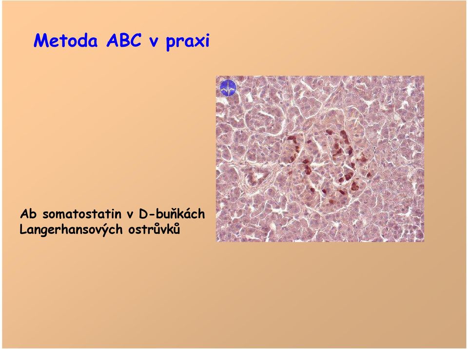 somatostatin v