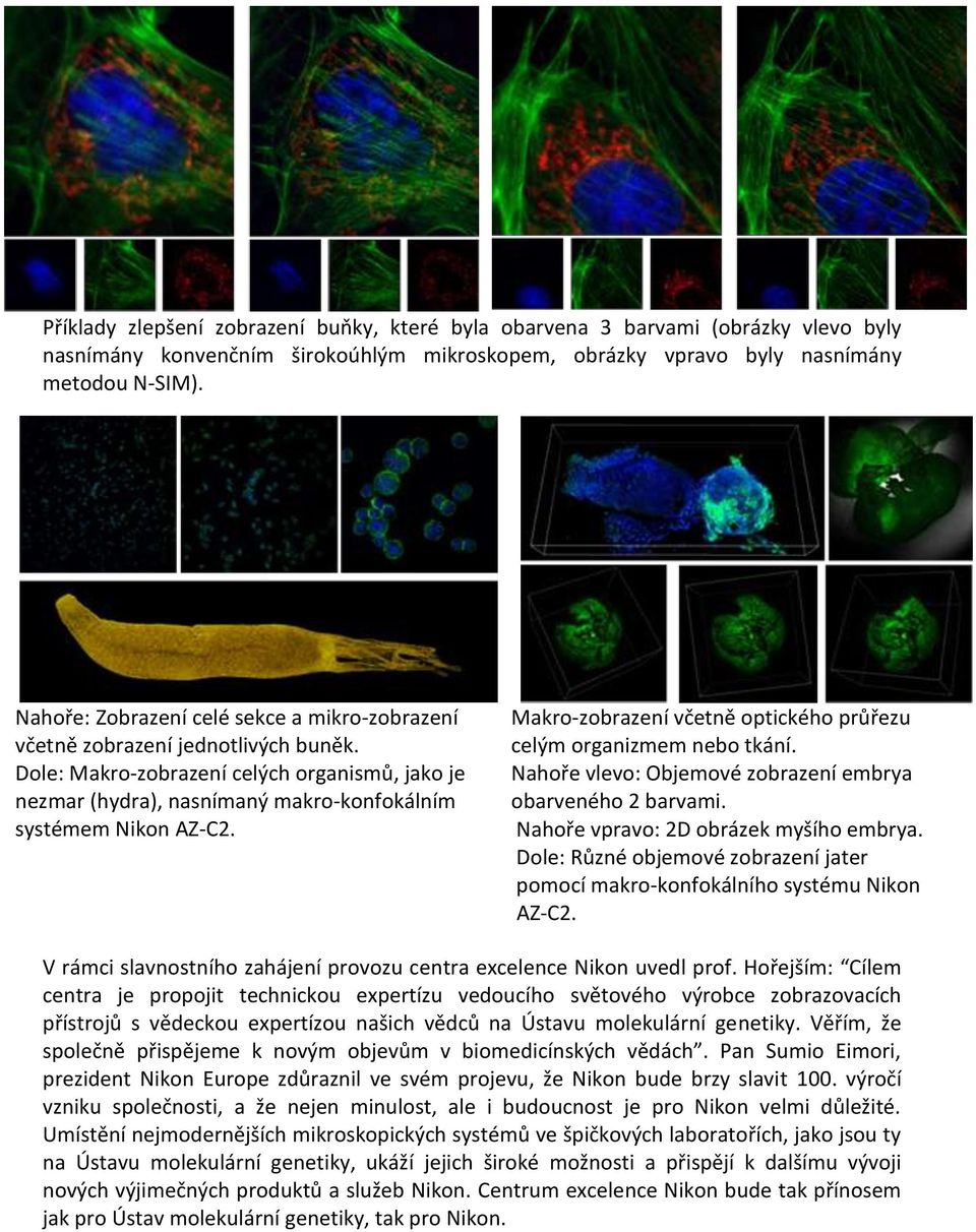 Makro-zobrazení včetně optického průřezu celým organizmem nebo tkání. Nahoře vlevo: Objemové zobrazení embrya obarveného 2 barvami. Nahoře vpravo: 2D obrázek myšího embrya.
