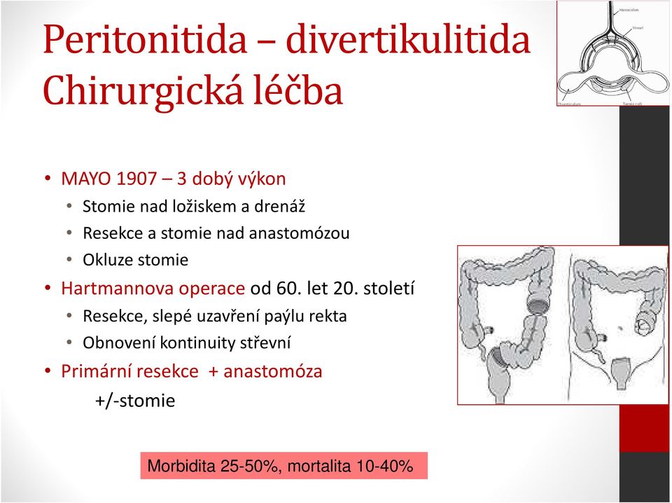 operace od 60. let 20.