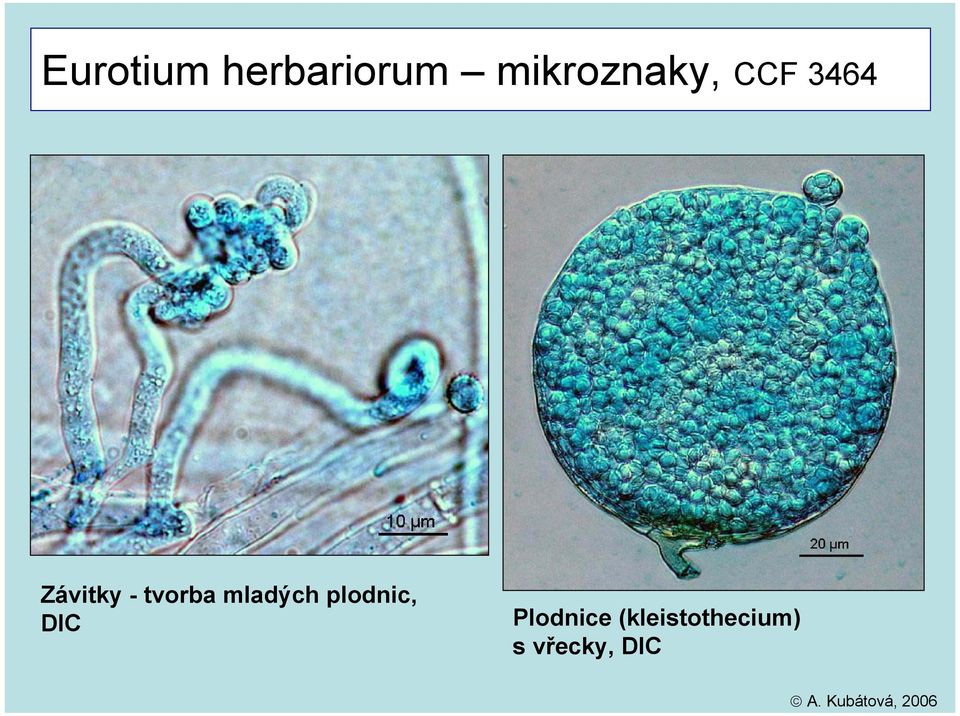 - tvorba mladých plodnic, DIC