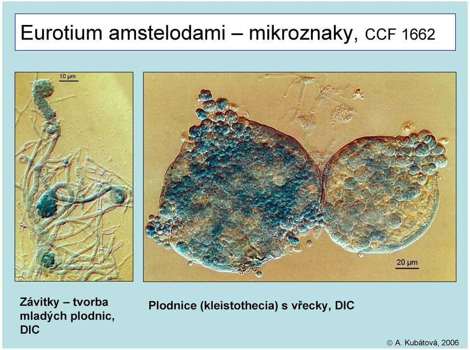 tvorba mladých plodnic, DIC