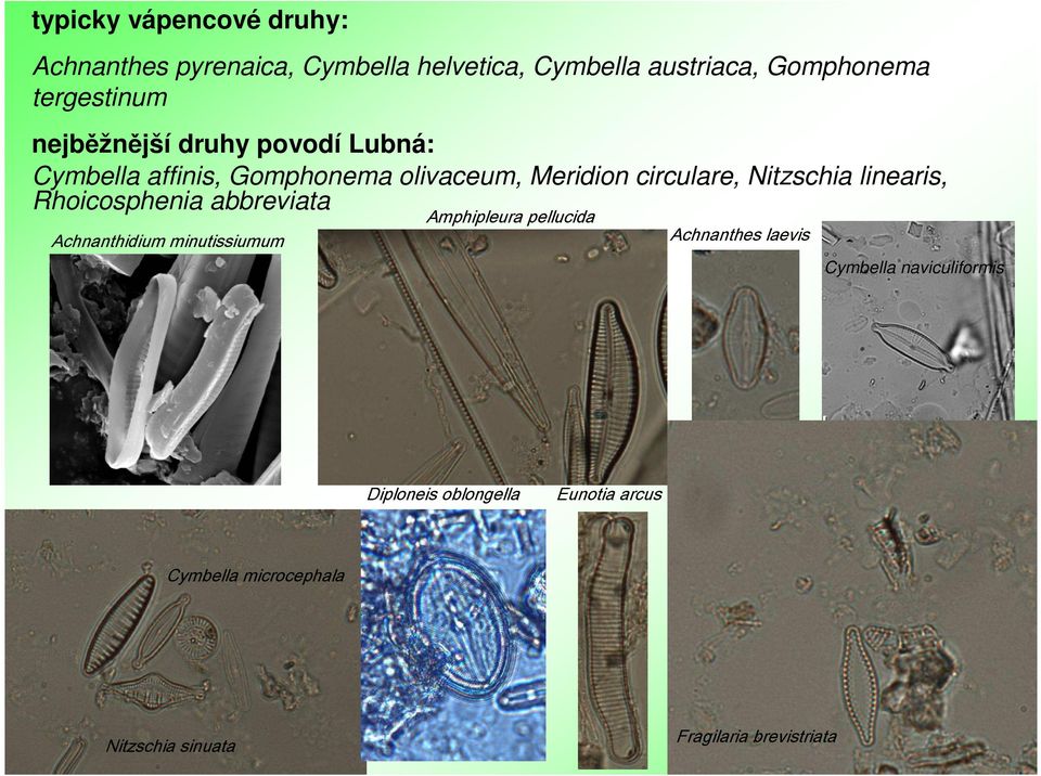 linearis, Rhoicosphenia abbreviata Achnanthidium minutissiumum Amphipleura pellucida Achnanthes laevis