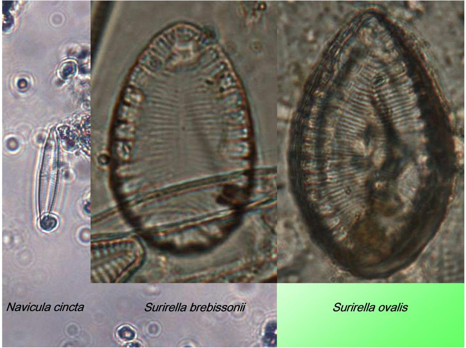 Surirella