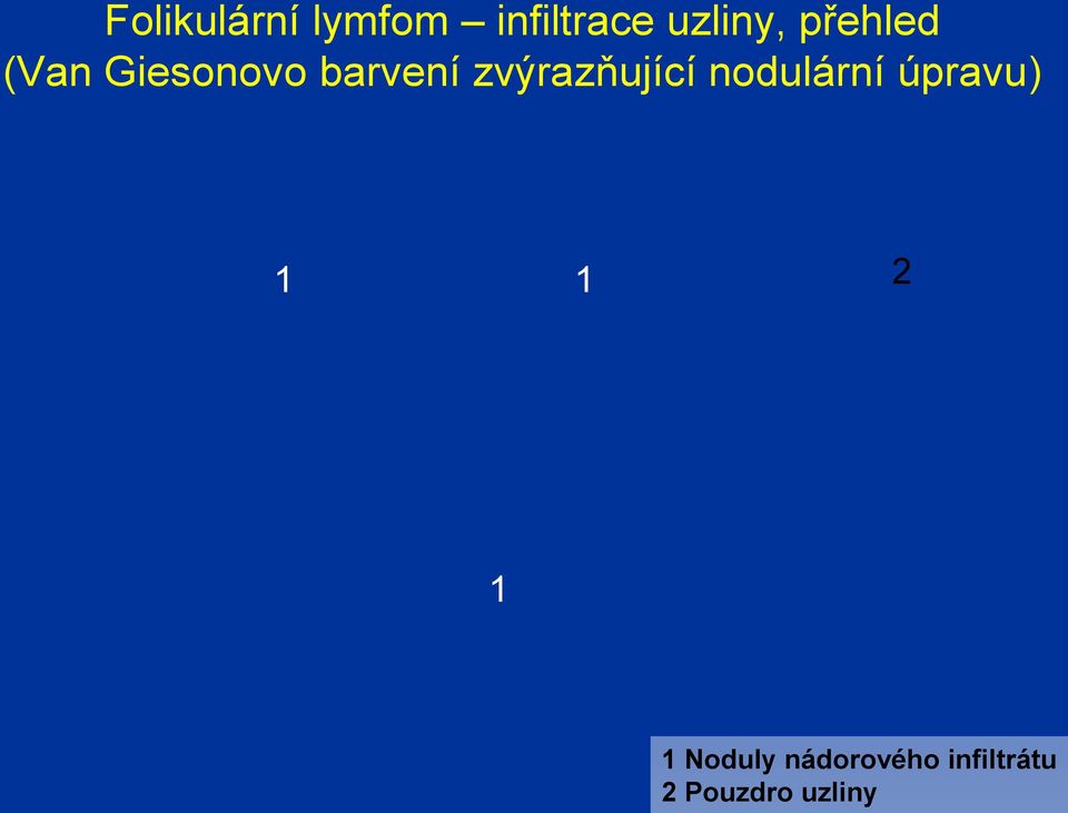 zvýrazňující nodulární úpravu) 1 1 2 1