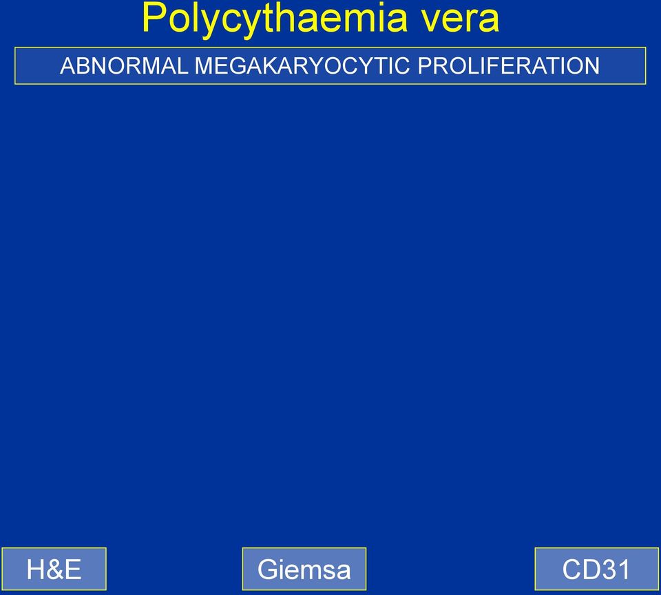 MEGAKARYOCYTIC