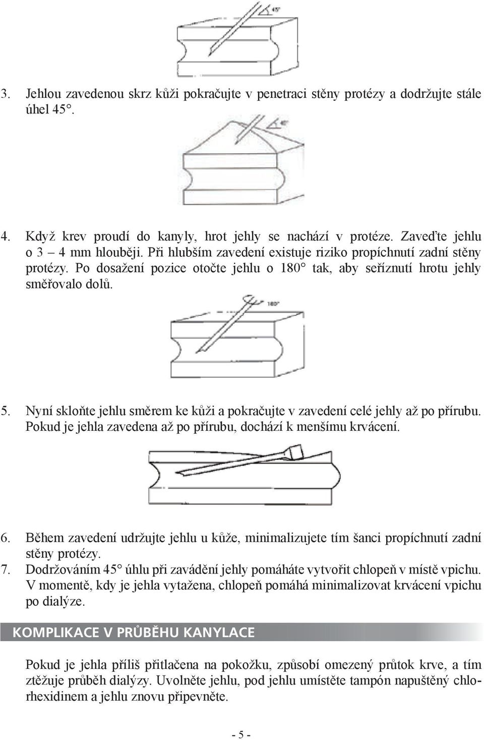 Nyní skloňte jehlu směrem ke kůži a pokračujte v zavedení celé jehly až po přírubu. Pokud je jehla zavedena až po přírubu, dochází k menšímu krvácení. 6. 7.