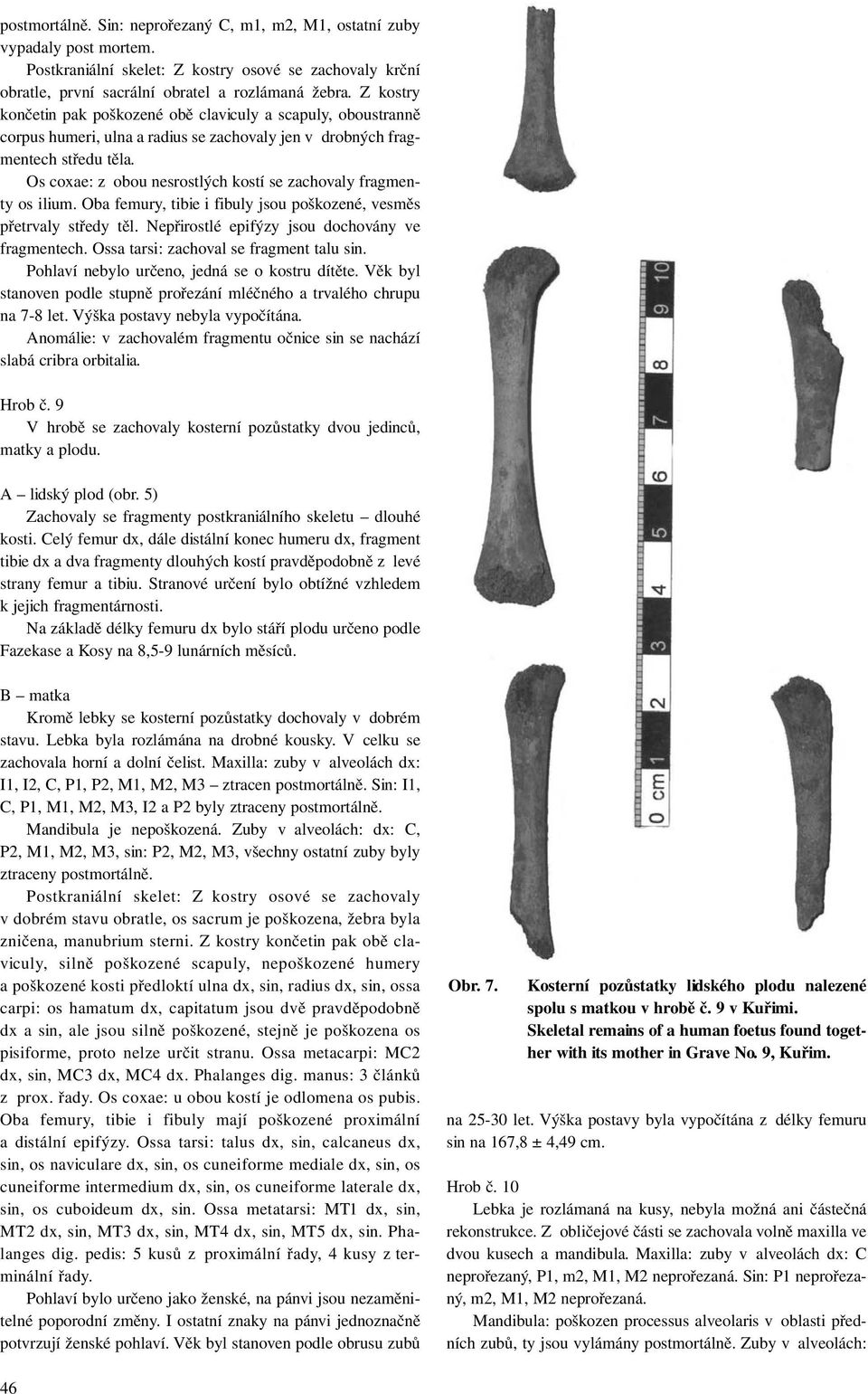Os coxae: z obou nesrostlých kostí se zachovaly fragmenty os ilium. Oba femury, tibie i fibuly jsou poškozené, vesměs přetrvaly středy těl. Nepřirostlé epifýzy jsou dochovány ve fragmentech.