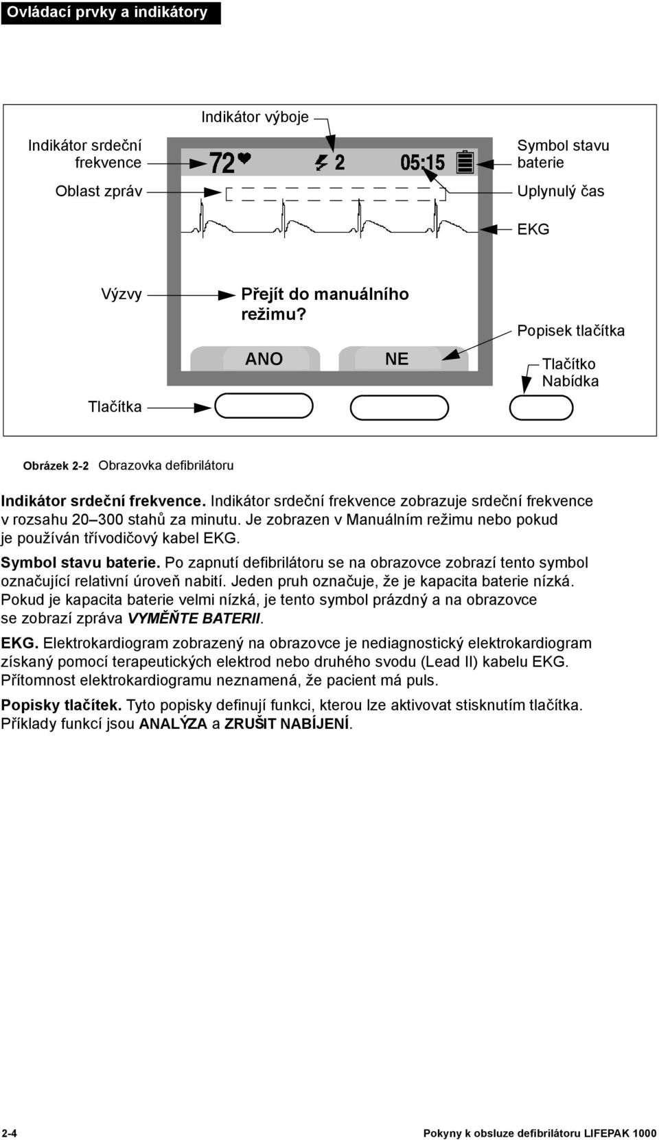 Je zobrazen v Manuálním režimu nebo pokud je používán třívodičový kabel EKG. Symbol stavu baterie. Po zapnutí defibrilátoru se na obrazovce zobrazí tento symbol označující relativní úroveň nabití.