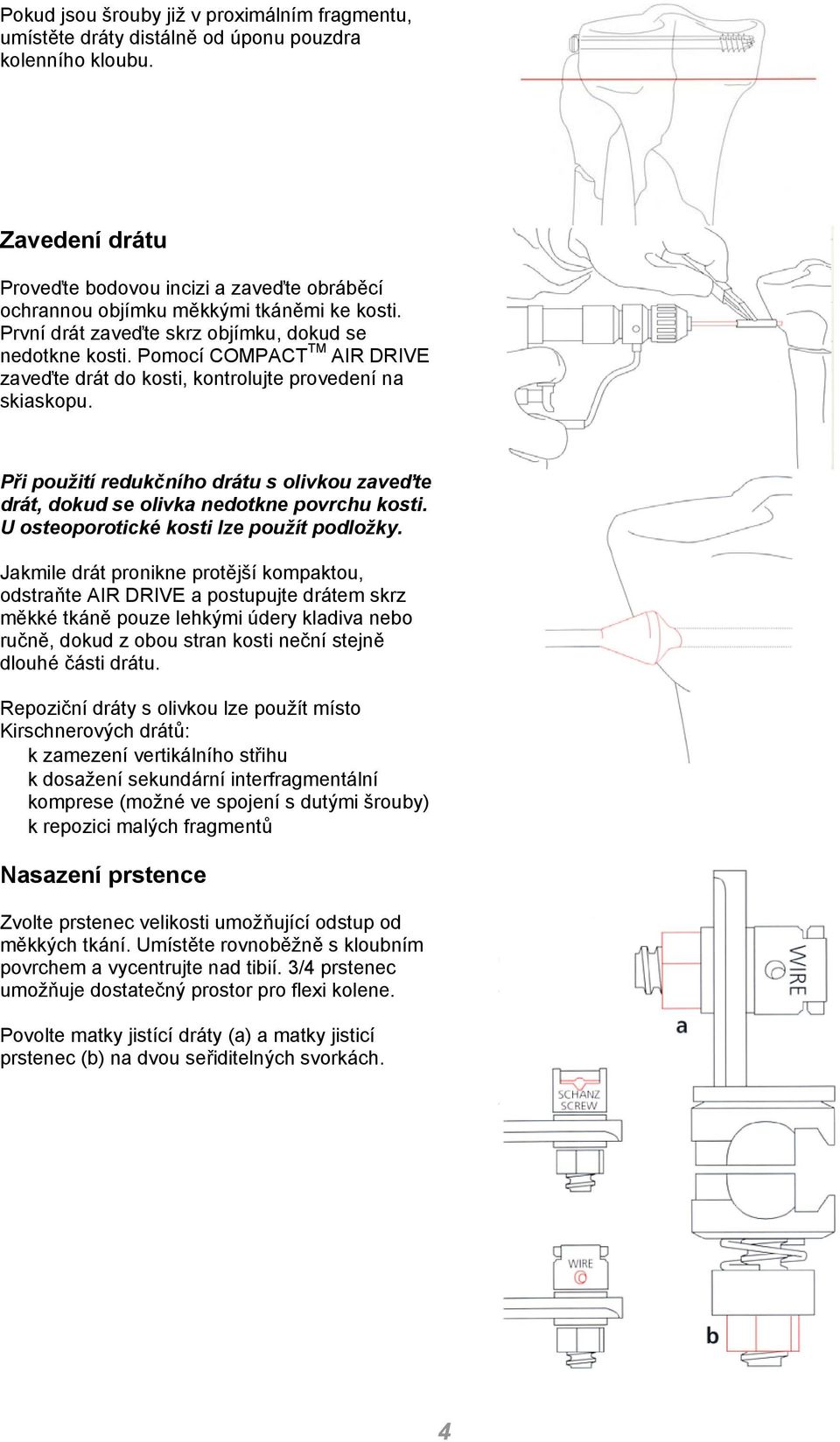 Pomocí COMPACT TM AIR DRIVE zaveďte drát do kosti, kontrolujte provedení na skiaskopu. Při použití redukčního drátu s olivkou zaveďte drát, dokud se olivka nedotkne povrchu kosti.