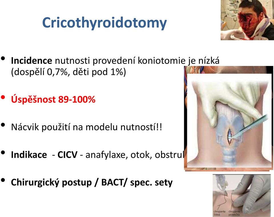 Nácvik použití na modelu nutností!