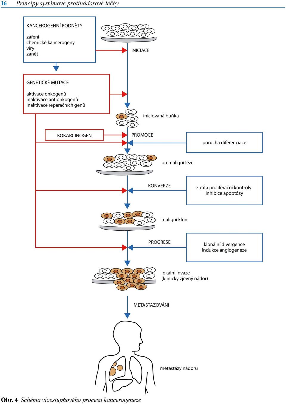 diferenciace premaligní léze KONVERZE ztráta proliferační kontroly inhibice apoptózy maligní klon PROGRESE klonální divergence