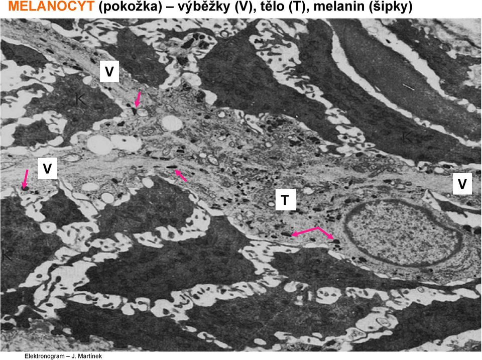 melanin (šipky) V V T