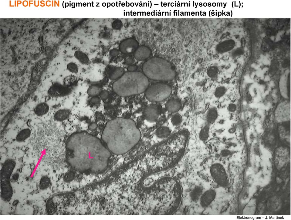 lysosomy (L); intermediární