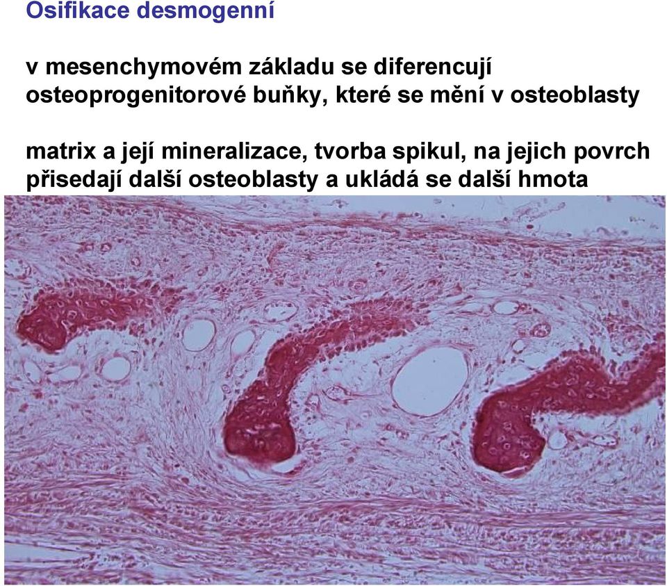 osteoblasty matrix a její mineralizace, tvorba spikul,