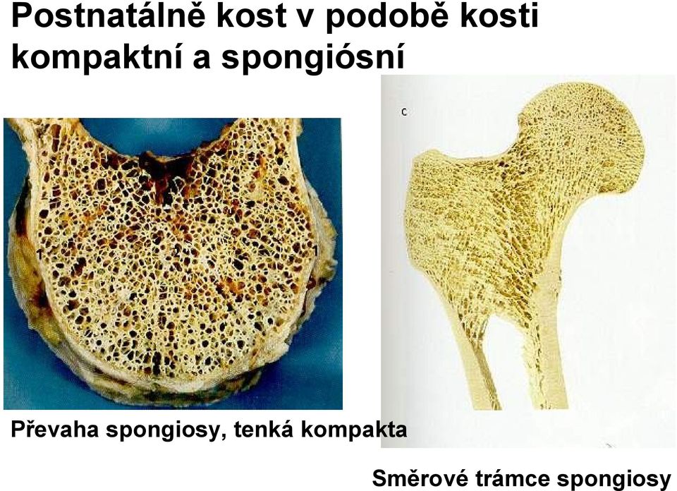 Převaha spongiosy, tenká