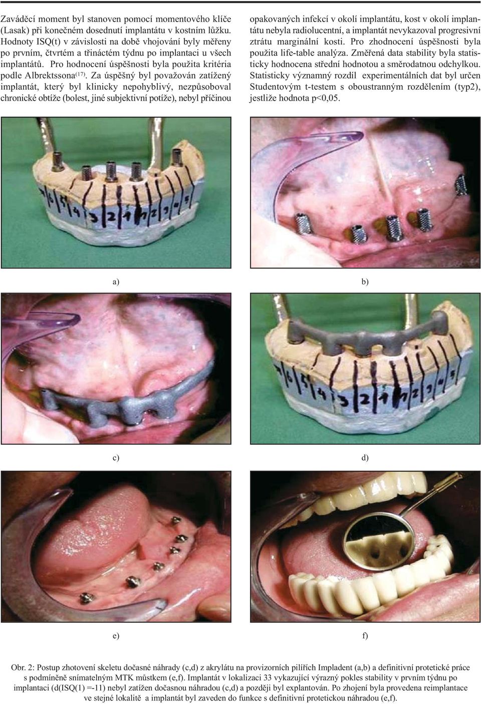 Za úspěšný byl považován zatížený implantát, který byl klinicky nepohyblivý, nezpůsoboval chronické obtíže (bolest, jiné subjektivní potíže), nebyl příčinou opakovaných infekcí v okolí implantátu,