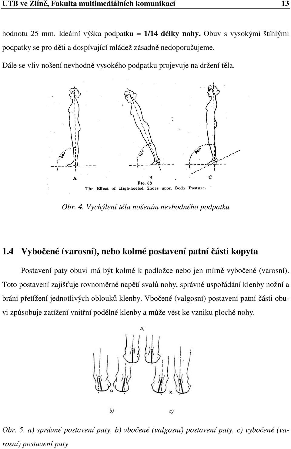 4 Vybočené (varosní), nebo kolmé postavení patní části kopyta Postavení paty obuvi má být kolmé k podložce nebo jen mírně vybočené (varosní).