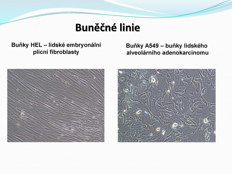 fibroblasty Buňky A549 buňky