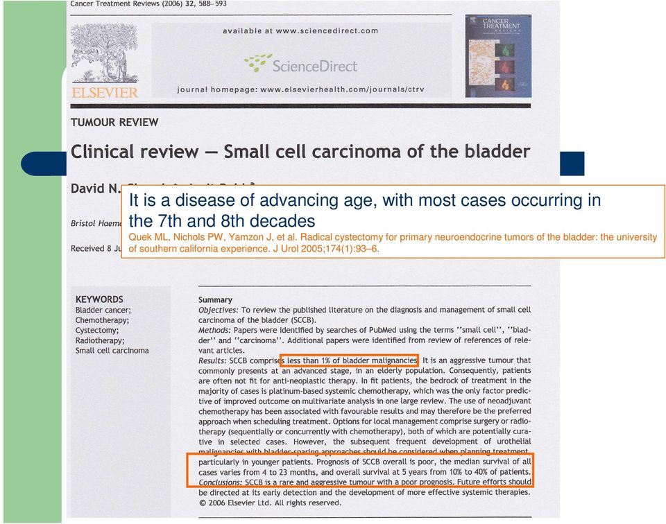 Radical cystectomy for primary neuroendocrine tumors of the