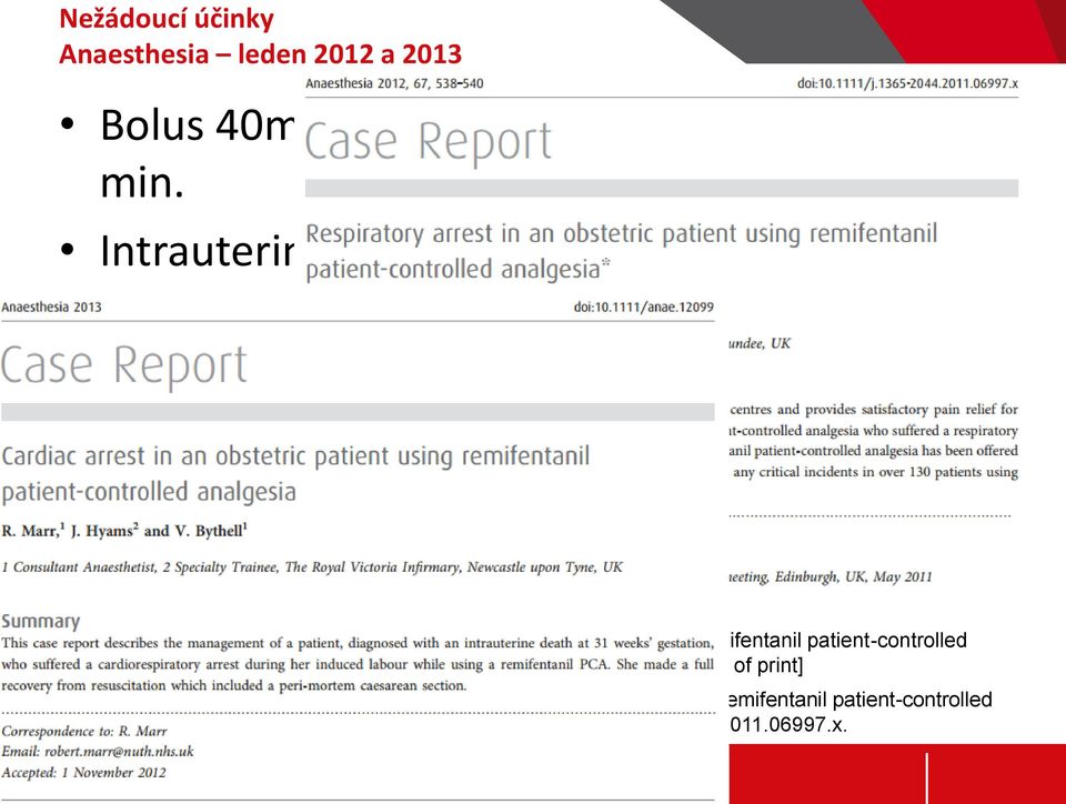 : Cardiac arrest in an obstetric patient using remifentanil patient-controlled analgesia. Anaesthesia. 2013 Jan 7. doi: 10.1111/anae.12099.