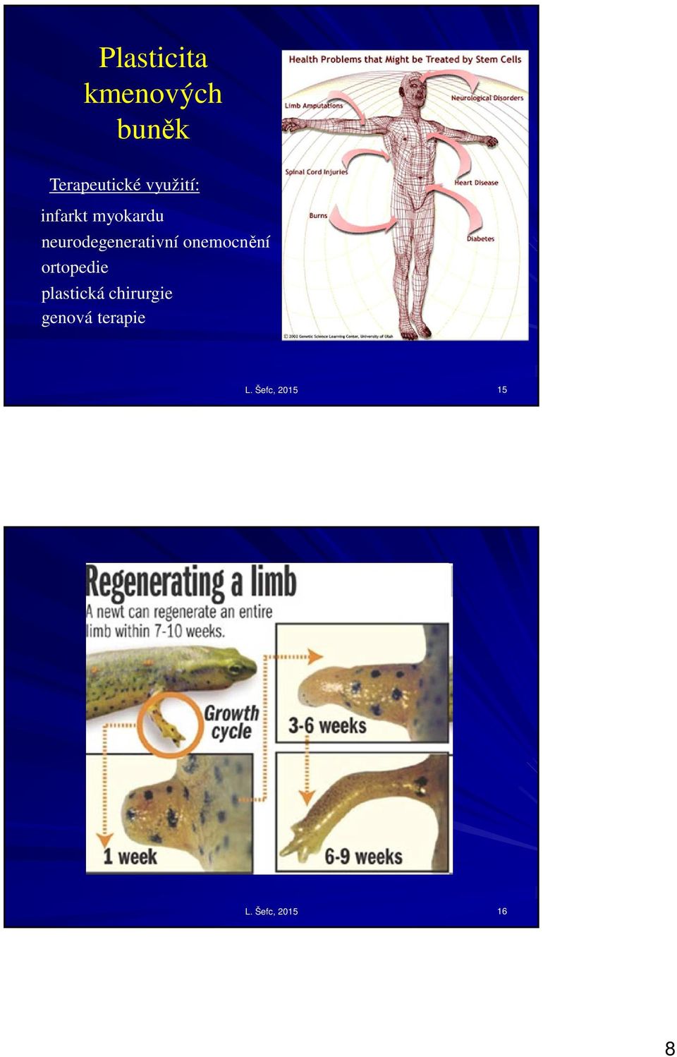 neurodegenerativní onemocnění ortopedie