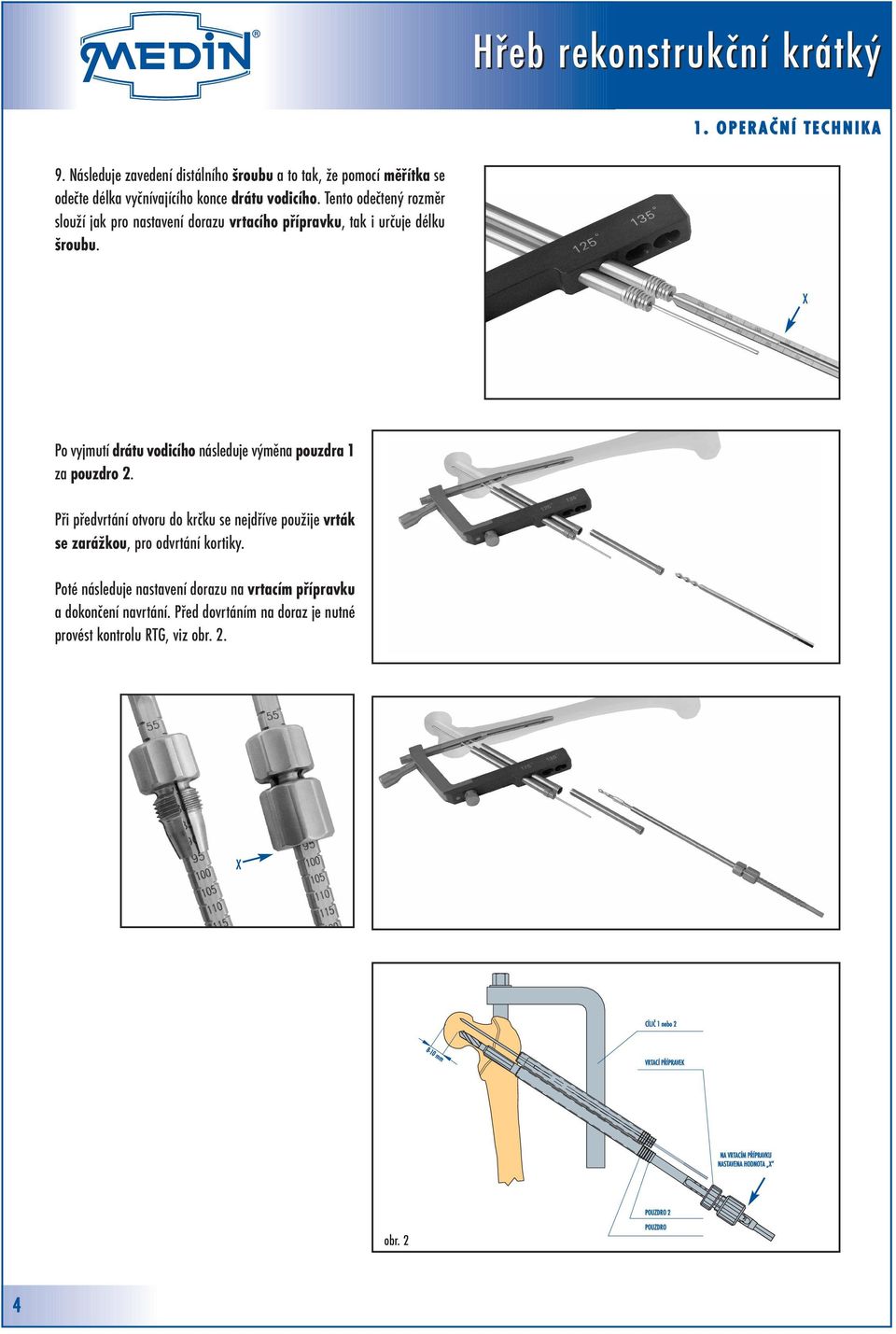 X Po vyjmutí drátu vodicího následuje výměna pouzdra 1 za pouzdro 2. Při předvrtání otvoru do krčku se nejdříve použije vrták se zarážkou, pro odvrtání kortiky.