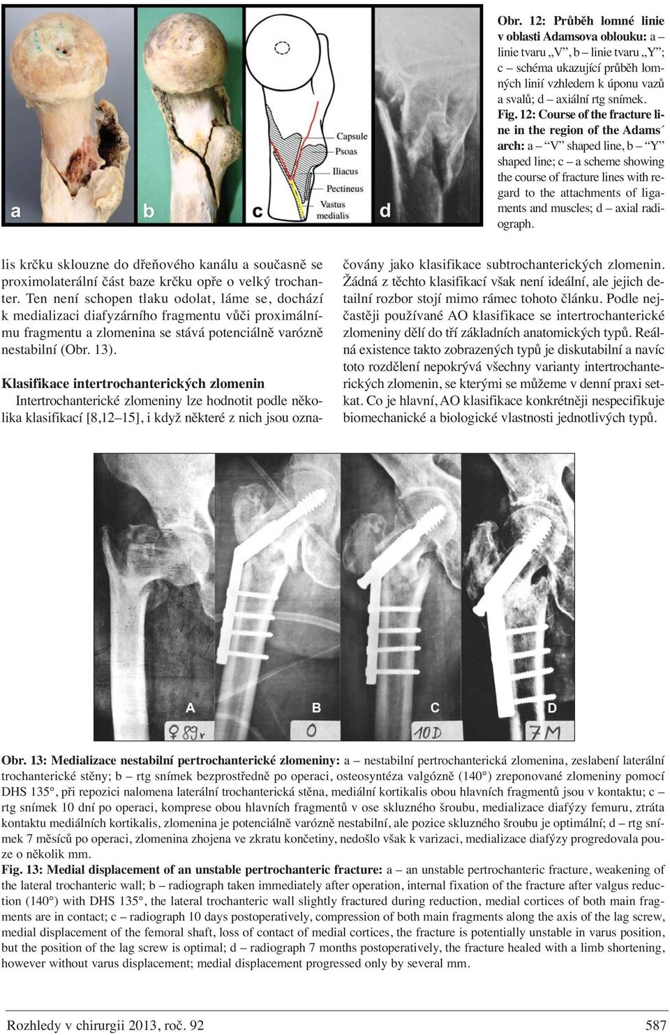 muscles; d axial radiograph. lis krčku sklouzne do dřeňového kanálu a současně se proximolaterální část baze krčku opře o velký trochanter.