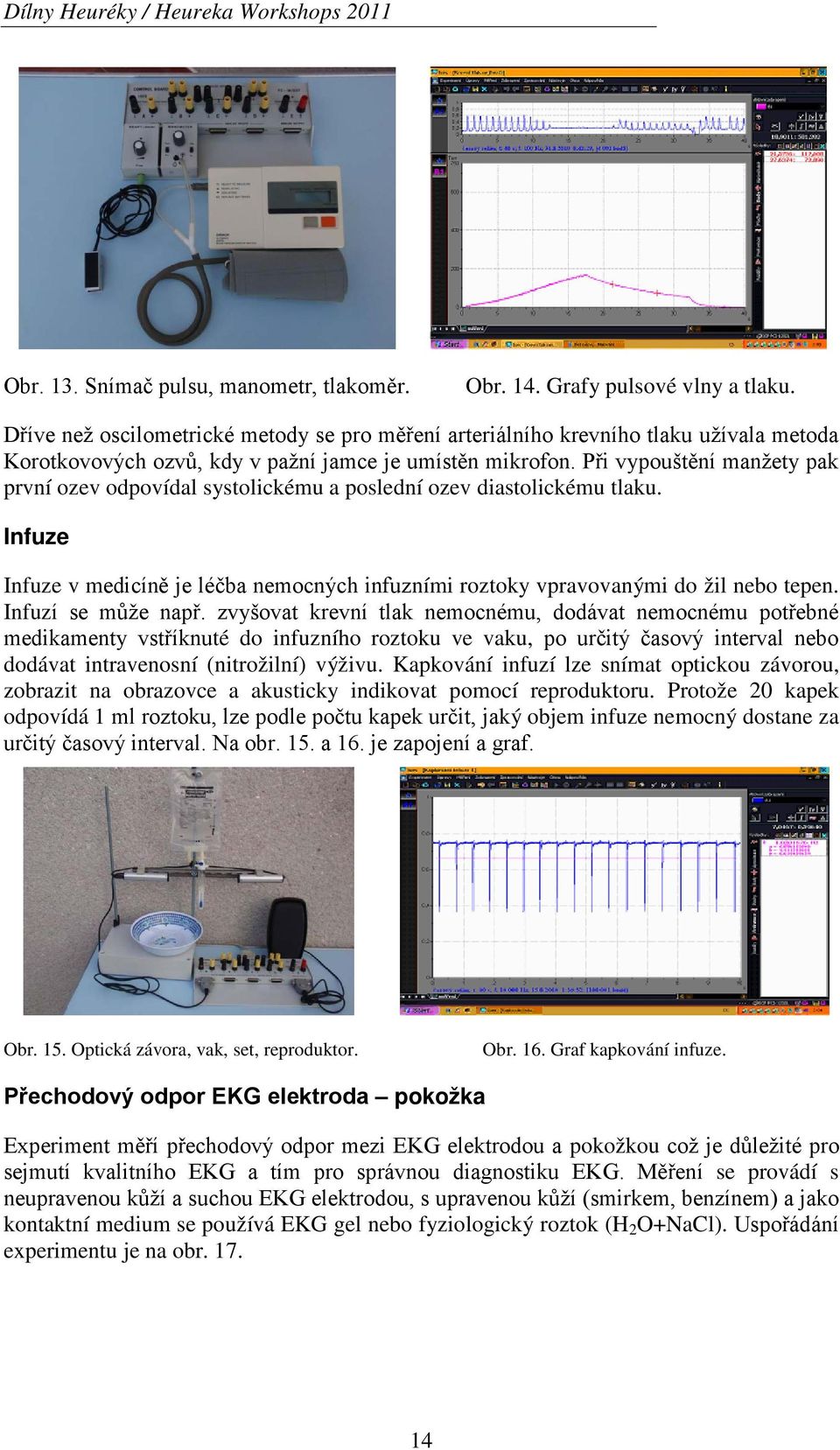 Při vypouštění manžety pak první ozev odpovídal systolickému a poslední ozev diastolickému tlaku. Infuze Infuze v medicíně je léčba nemocných infuzními roztoky vpravovanými do žil nebo tepen.