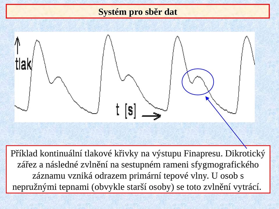 Dikrotický zářez a následné zvlnění na sestupném rameni