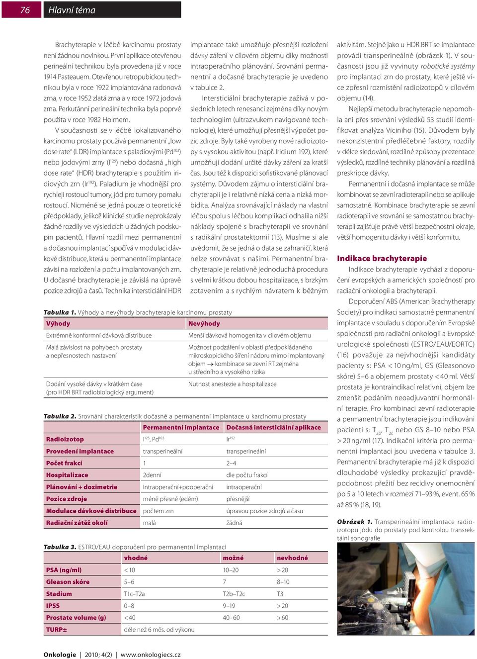 V současnosti se v léčbě lokalizovaného karcinomu prostaty používá permanentní low dose rate (LDR) implantace s paladiovými (Pd 103 ) nebo jodovými zrny (I 125 ) nebo dočasná high dose rate (HDR)