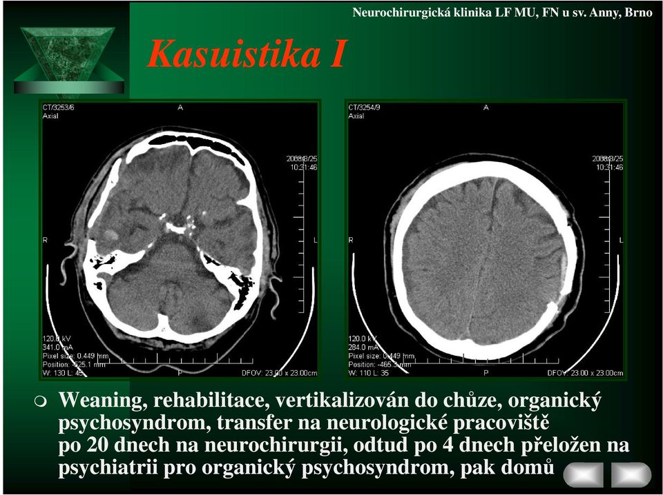 pracoviště po 20 dnech na neurochirurgii, odtud po 4