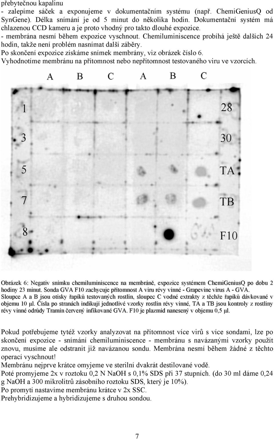 Chemiluminiscence probíhá ještě dalších 24 hodin, takže není problém nasnímat další záběry. Po skončení expozice získáme snímek membrány, viz obrázek číslo 6.