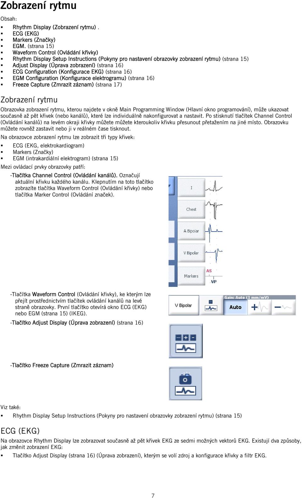 Configuration (Konfigurace EKG) (strana 16) EGM Configuration (Konfigurace elektrogramu) (strana 16) Freeze Capture (Zmrazit záznam) (strana 17) Zobrazení rytmu Obrazovka zobrazení rytmu, kterou