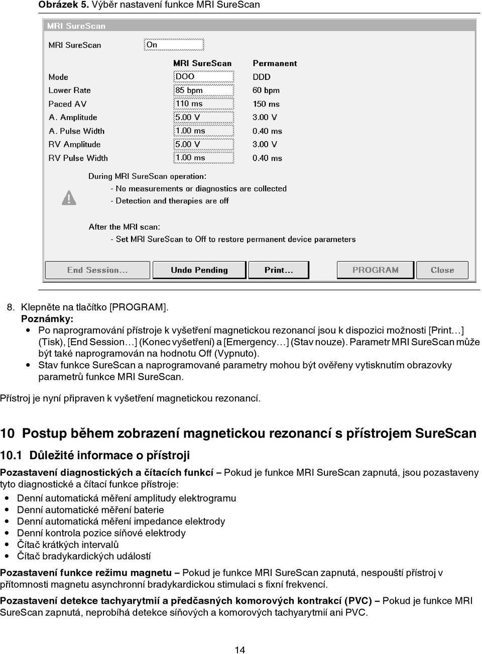 Parametr MRI SureScan může být také naprogramován na hodnotu Off (Vypnuto). Stav funkce SureScan a naprogramované parametry mohou být ověřeny vytisknutím obrazovky parametrů funkce MRI SureScan.